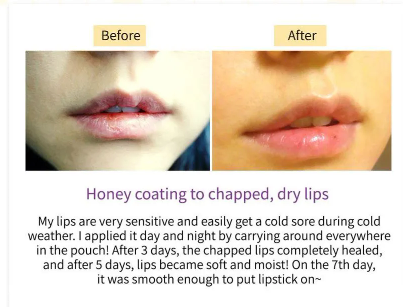 FRUIDA Hydrating Honey Lip Balm: Avocado Cica Relief